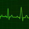 eletrocardiograma